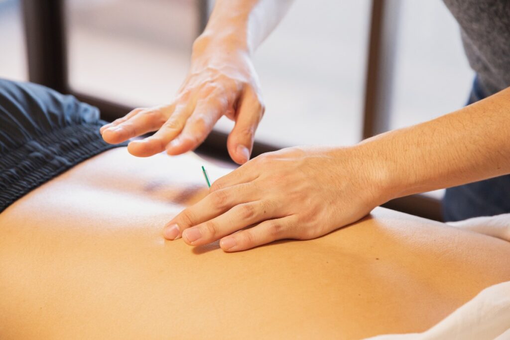 How Can Acupuncture Benefit Addiction Recovery?